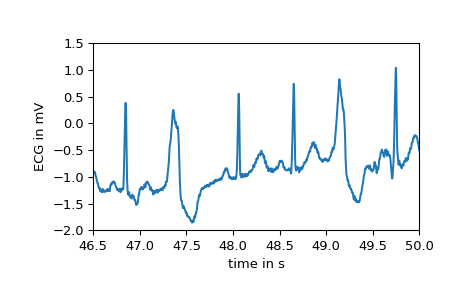 ../../_images/scipy-misc-electrocardiogram-1_01_00.png